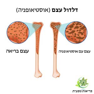 דלדול עצם (אוסטיאופניה)