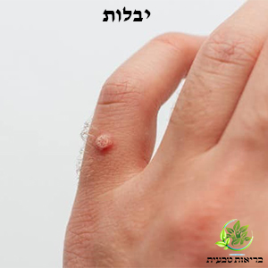 יבלות בכף הרגל | המרכז לבריאות טבעית