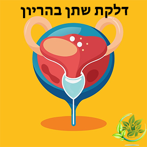 דלקת שתן בהריון