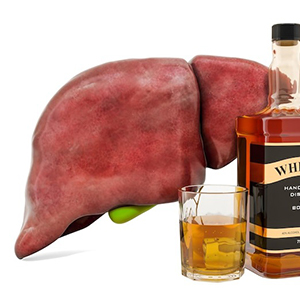 הקשר בין אלכוהול לכבד